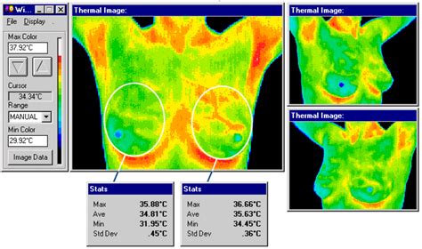 What the Doctors Are Saying – Las Vegas Thermography.